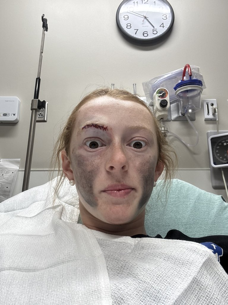 Emma Kate Champion (EK) tweet media