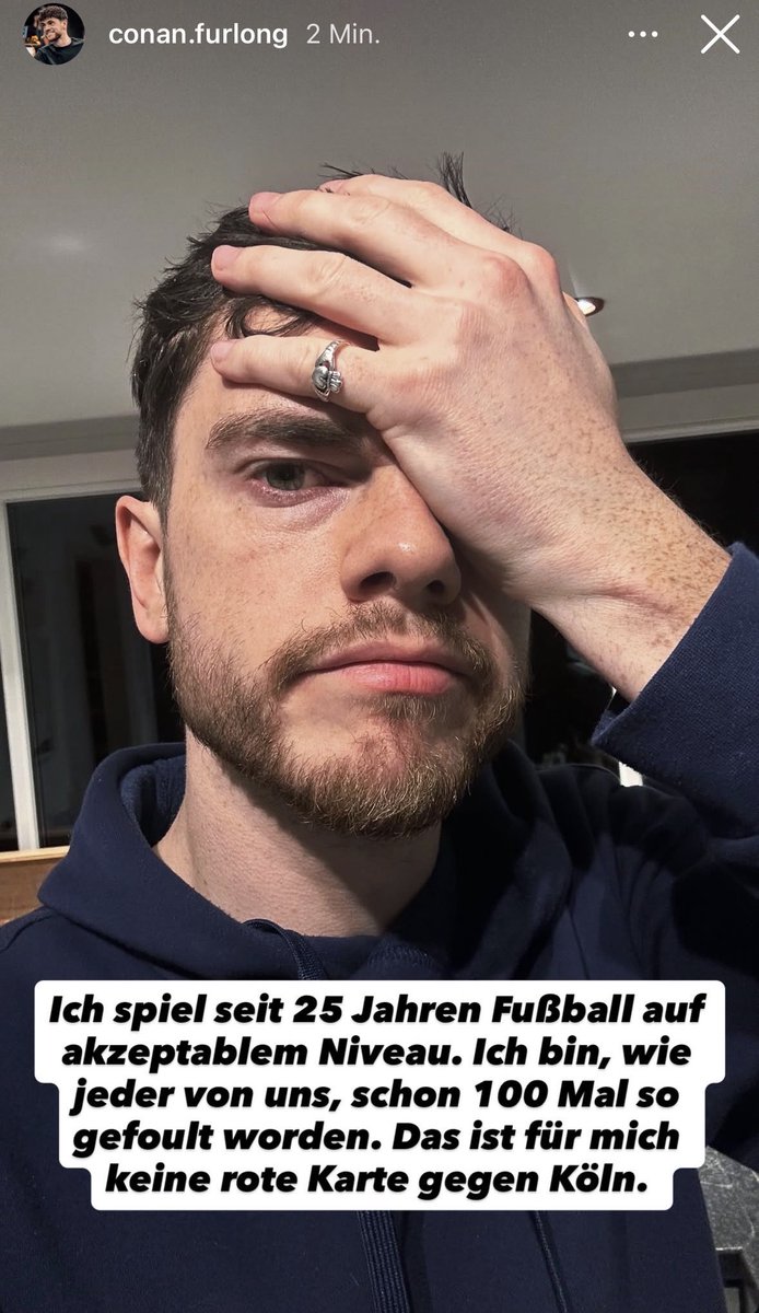 SchieckKeenan's tweet photo. Na was denn jetzt? Werdet euch mal einig! 🌚
#FCKBVB https://t.co/883siFqHX6