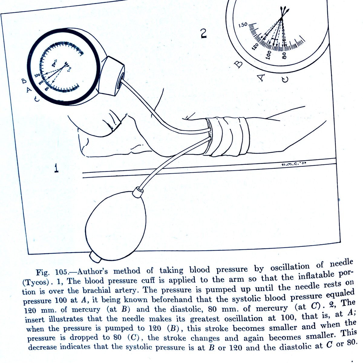 Merlin Larson, MD tweet media