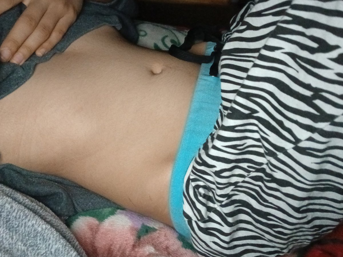 sweetapplegail's tweet photo. Before and After one week of eating 2500 cals everyday.. Haven't weighed myself https://t.co/u0sJELnhAu