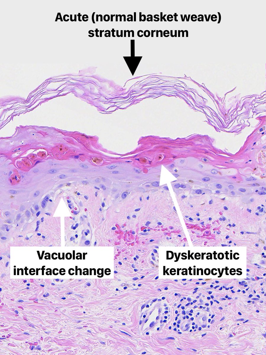 Toby Schmitt, MD tweet media