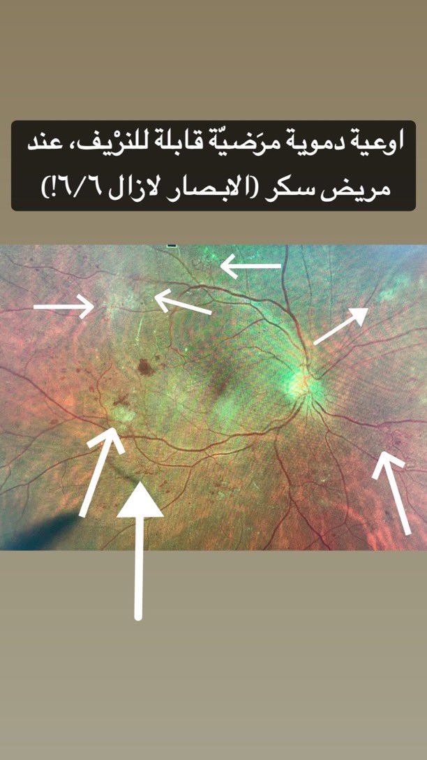 د. عبدالمجيد الفاخري (دكتور شبكية) tweet media