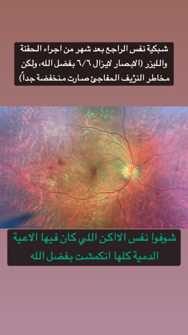 د. عبدالمجيد الفاخري (دكتور شبكية) tweet media