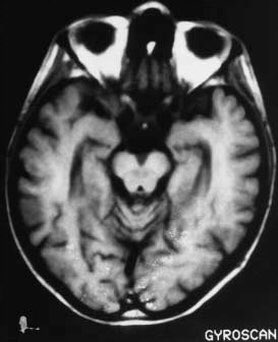 ່wonyette ♞ bmi 13 jail tweet media