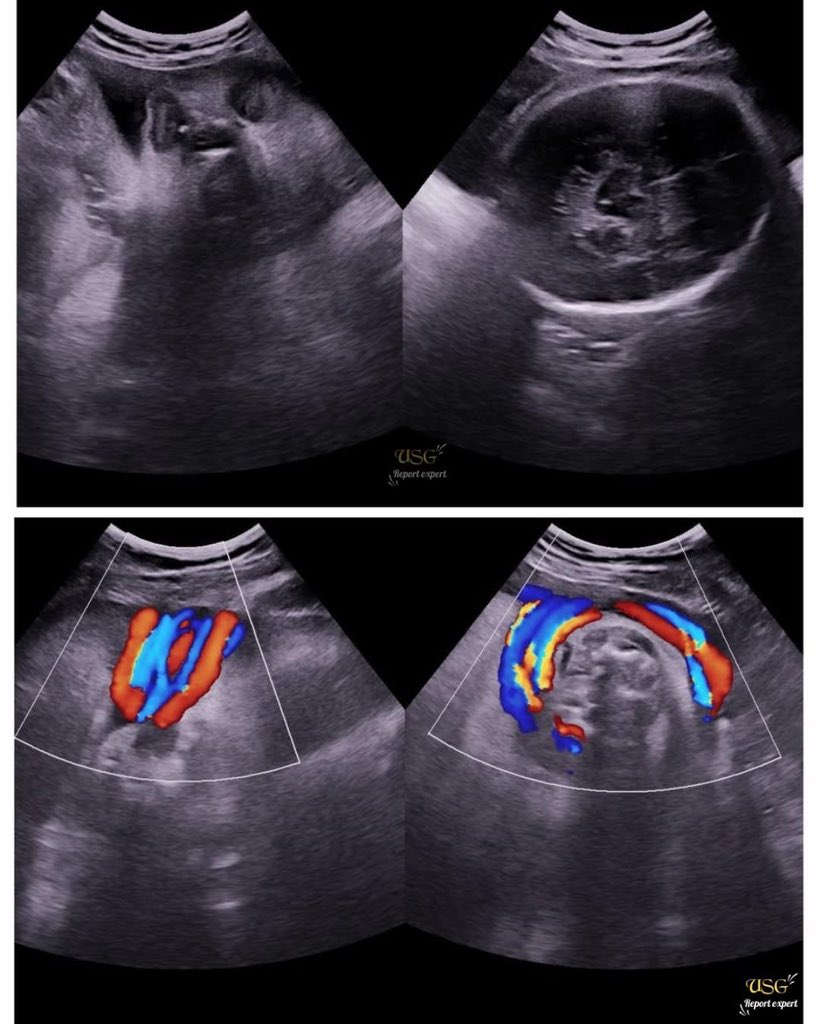 EchoTech tweet media