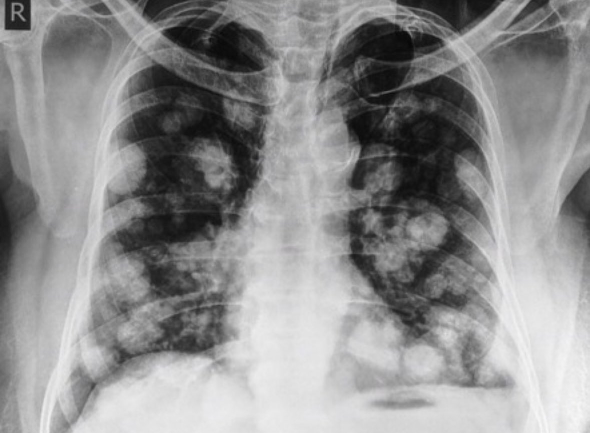 Mohammed Al-Shehri 🇸🇦 tweet media