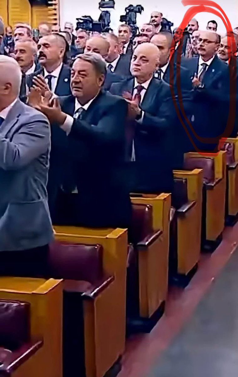 nzmucar's tweet photo. @mbekci74 Doktor bu ne??? https://t.co/r4EeWSJvOI
