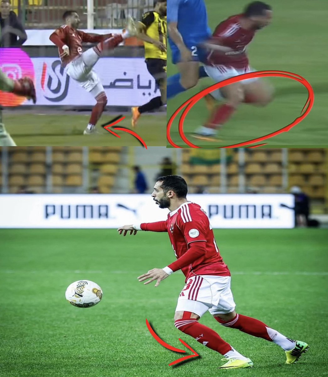 ROMANYRAOUF8's tweet photo. عن طريق التحليل الحركي تعرف انه مكانش صدفة ان كريم فؤاد يتصاب بالرباط الصليبي 3 مرات
لو خدت بالك و بصيت على رجل كريم هتلاقيه بيبدأ الانطلاقة او الخطوة اللي هيعملها بالطريقة دي
اللي هي اصلا بتكون طريقة قطع الرباط الصليبي
ودة دليل واضح على التلقائية الخطأ اللي عند كريم https://t.co/7S9bQ8RgEd