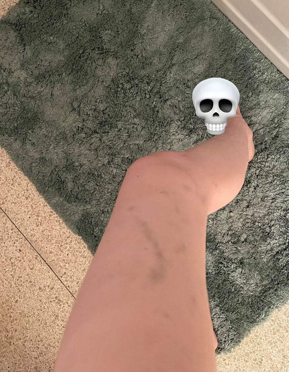 ╋━𝕷𝖎𝖙𝖙𝖑𝖊_𝕾𝖑𝖆𝖘𝖍𝖊𝖗_𝕭𝖚𝖓𝖓𝖎🔪🐇 tweet media