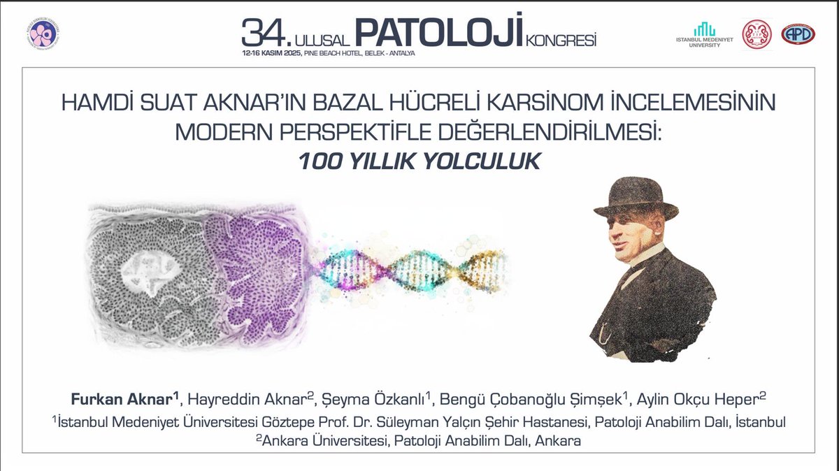 profhamdisuat's tweet photo. 34.⁠ ⁠Ulusal Patoloji Kongresi’nde “Hamdi Suat Aknar’ın Bazal Hücreli Karsinom İncelemesinin Modern Perspektifle Değerlendirilmesi: 100 Yıllık Yolculuk” çalışması özel ödüle layık görüldü.
#Pathology #UlusalPatolojiKongresi #BasalCellCarcinoma https://t.co/1akvSqz8qr