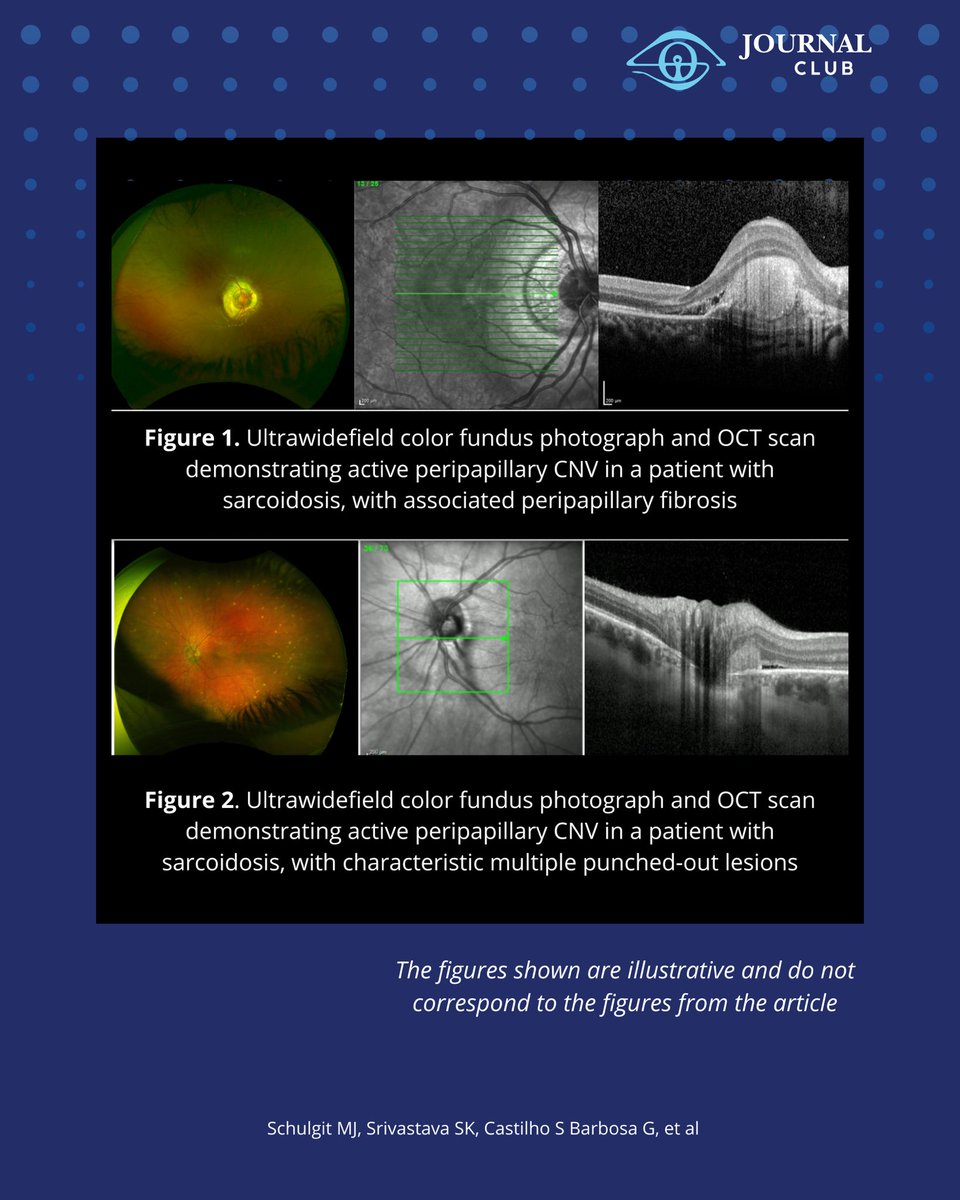 IOIS - International Ocular Inflammation Society tweet media