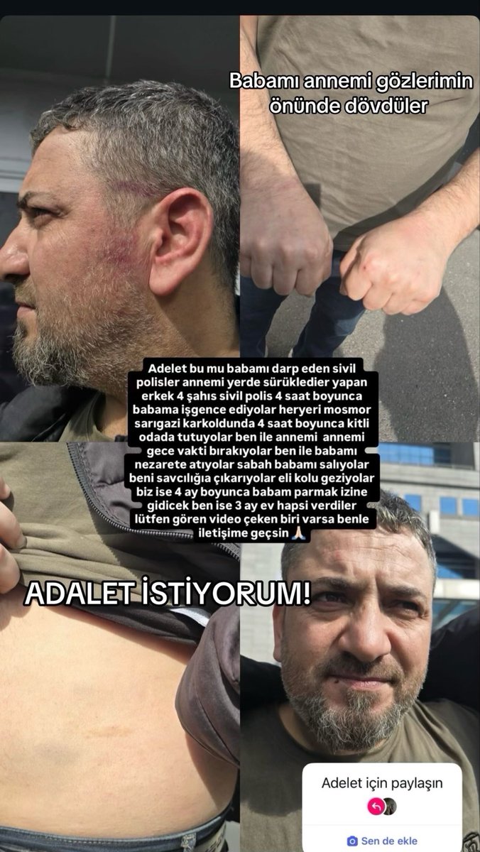 mira_sahra2's tweet photo. #sedatpeker #hasthag #yardım #destek #SEDATPEKERREİS https://t.co/f1SWoDwloE