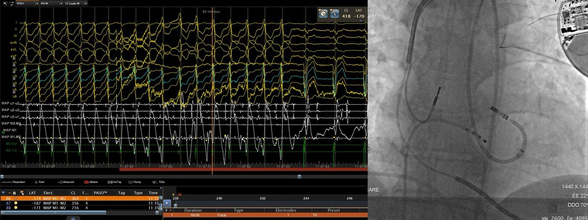 Giovanni Coluccia tweet media