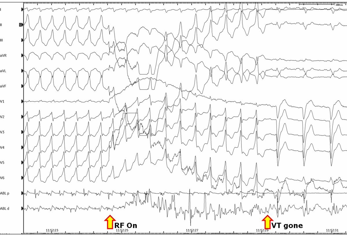 Giovanni Coluccia tweet media