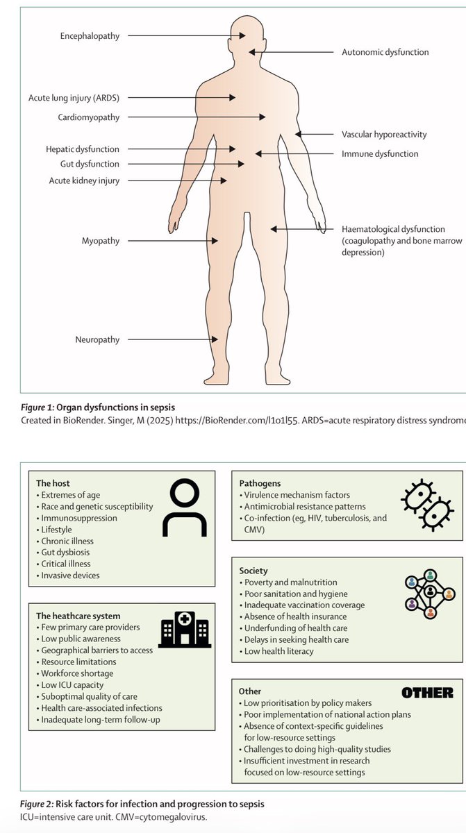 manuel_aguirrec's tweet photo. Sepsis 2026 por Lancet 

🔑 Criterio clínico operativo (Sepsis-3)
➡️ Incremento ≥2 puntos en SOFA respecto al basal.

📊 Choque séptico
•Necesidad de vasopresores para mantener PAM ≥65 mmHg
•Lactato >2 mmol/L
•Persistente a pesar de líquidos adecuados.

Sitios de infección más frecuentes

1️⃣ Pulmón
2️⃣ Abdomen
3️⃣ Bacteriemia
4️⃣ Tracto urinario

Órganos afectados:
🧠 encefalopatía
🫁 SDRA
❤️ cardiomiopatía séptica
🩸 coagulopatía
🧾 disfunción hepática
🧃 falla renal aguda
💪 miopatía y neuropatía

Herramientas diagnósticas: 
•SOFA
•qSOFA
•NEWS2

Estudios clave

🧪 Laboratorio
•leucocitos
•PCR
•procalcitonina
•lactato

🦠 Microbiología
•hemocultivos
•cultivos de foco

🖥 Imagen
•RX
•TAC
•USG

⏱ Tiempo ideal:
•choque séptico → ≤1 hora
•sospecha sin choque → ≤3 horas

Claves del manejo:
💉 antibióticos tempranos
💧 cristaloides (~30 mL/kg)
📈 norepinefrina si hipotensión
🔍 control del foco

#Sepsis #UCI #MedicinaInterna
#Infecto #ENARM #Residencia #Choque