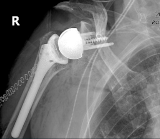 Rick Matsen tweet media