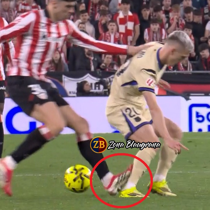 🚨EXPULSIÓN PERDONADA A REGO EN EL MINUTO 50‼️

▫️ Pizarro Gómez no intervino desde el VAR y perdonó la expulsión al jugador del Athletic, el árbitro del colegio madrileño fue premiado con este partido, después de no intervenir en la agresión de Rudiger a Diego Rico.