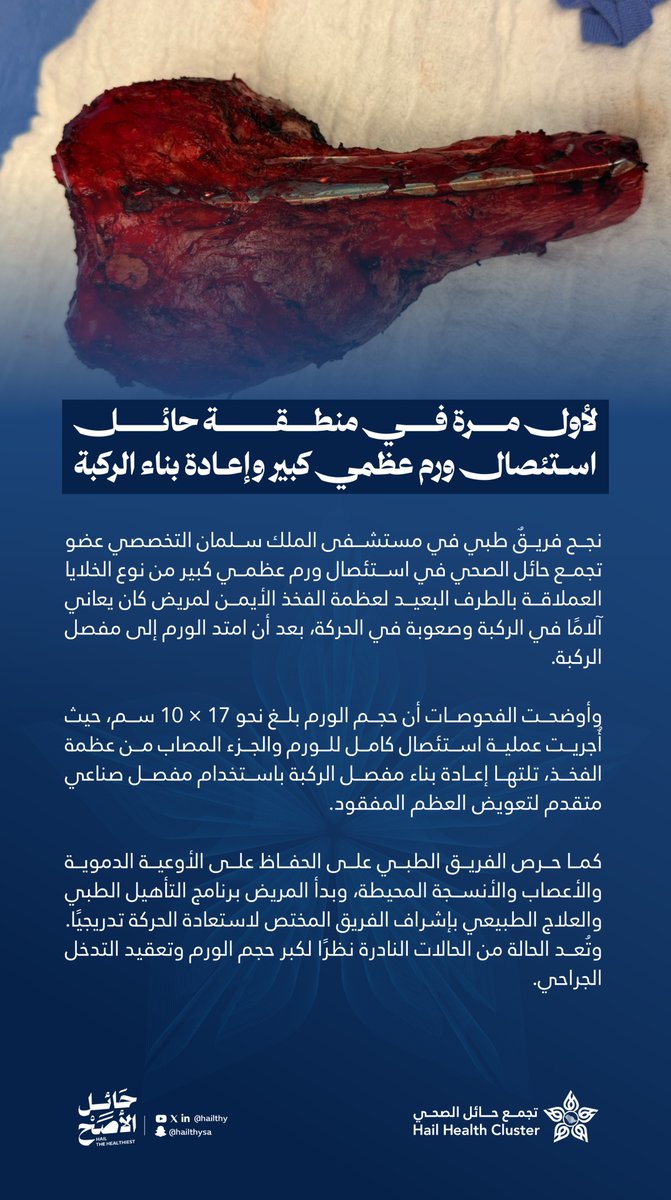 تجمع حائل الصحي tweet media