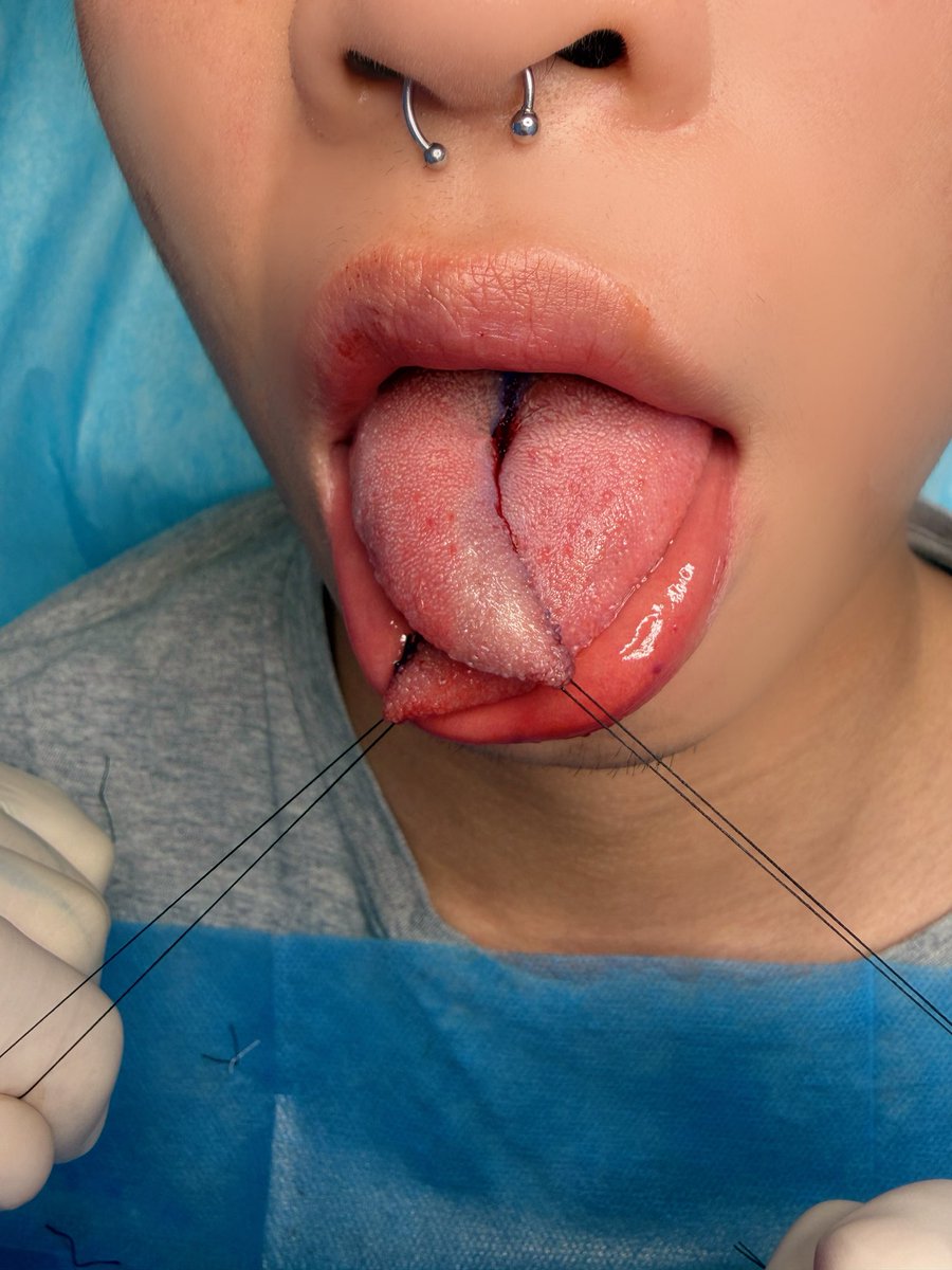 穿孔师涣木 tweet media