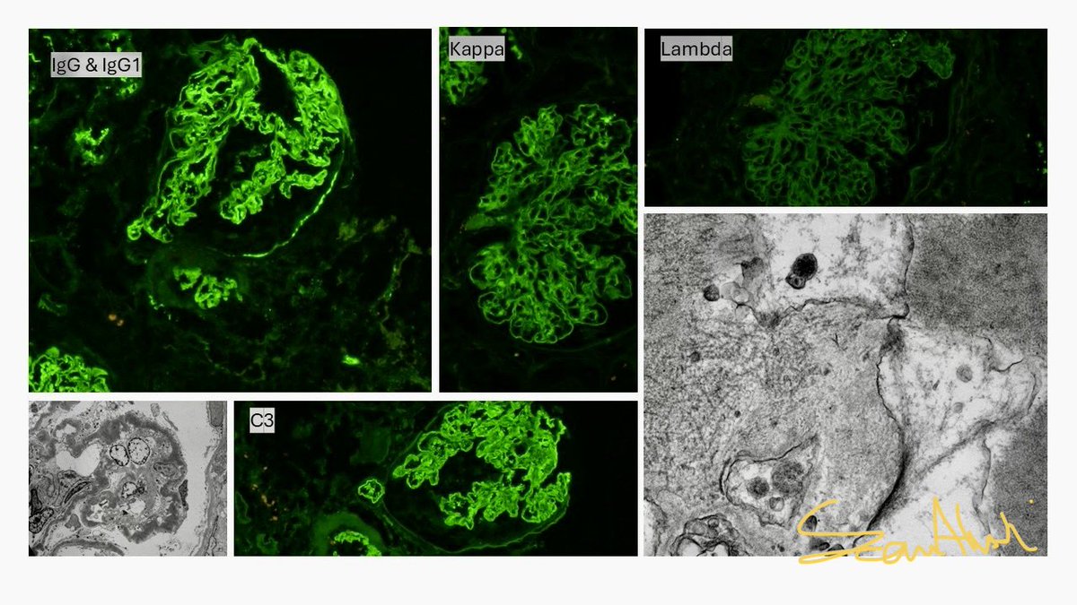 Sam Albadri, M.D., M.Sc. tweet media