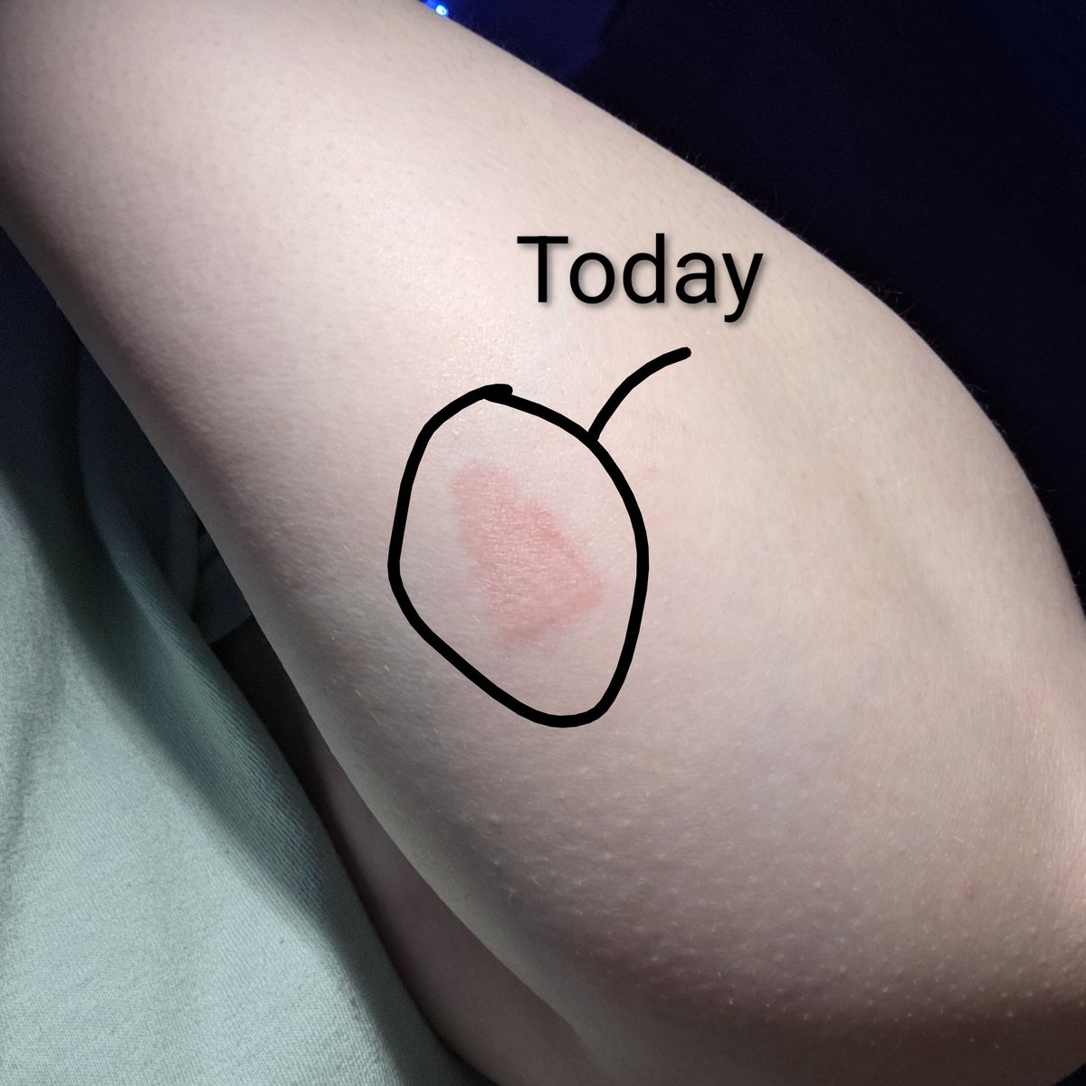 🪷 Eryn 🍭 tweet media