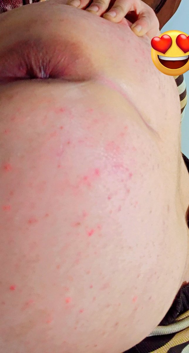 زبدة🇹🇳 tweet media