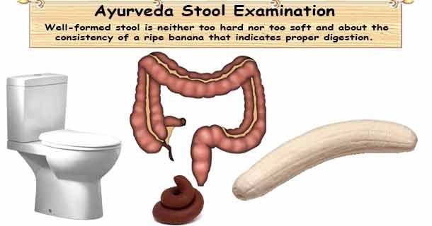 healthyojas's tweet image. Ayurveda Stool Diagnosis buff.ly/8wfXcqc #Ayurveda #Stool #Diagnosis