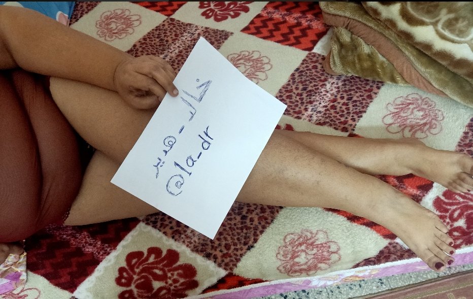 1a_dr's tweet photo. مفيش هزار
مفيش خيار
تنور مملكتي تحت رجولي بشروطي
شايف نفسك مش قدها ماشوفكش خاص https://t.co/Y6X8Awqul6