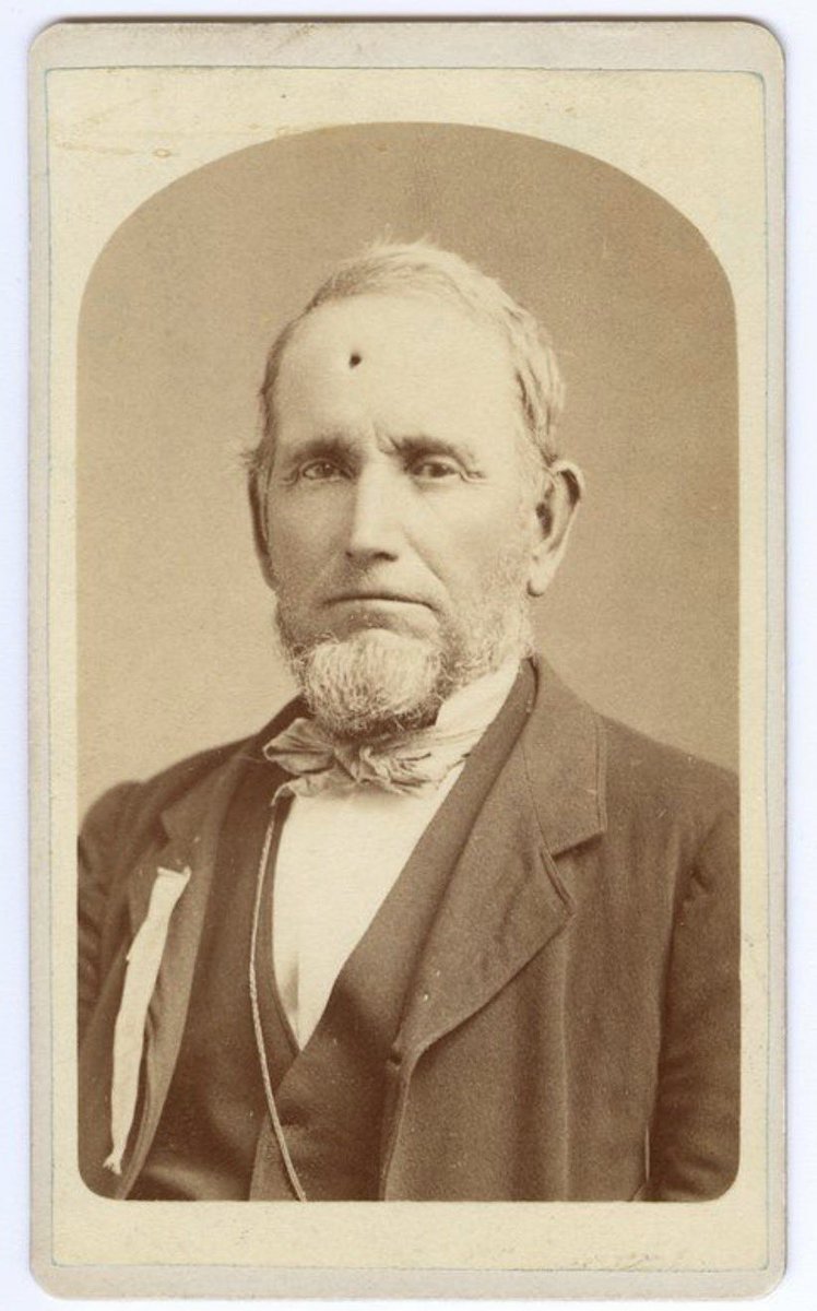 ￼
Abraham “Bullet Hole” Ellis
 
Abraham “Bullet Hole” Ellis was an abolitionist who had been associated with John Brown earlier. He lived in Miami County, Kansas and was caught up in the violent border conflicts between pro-slavery and anti-slavery factions. 

When the Civil war