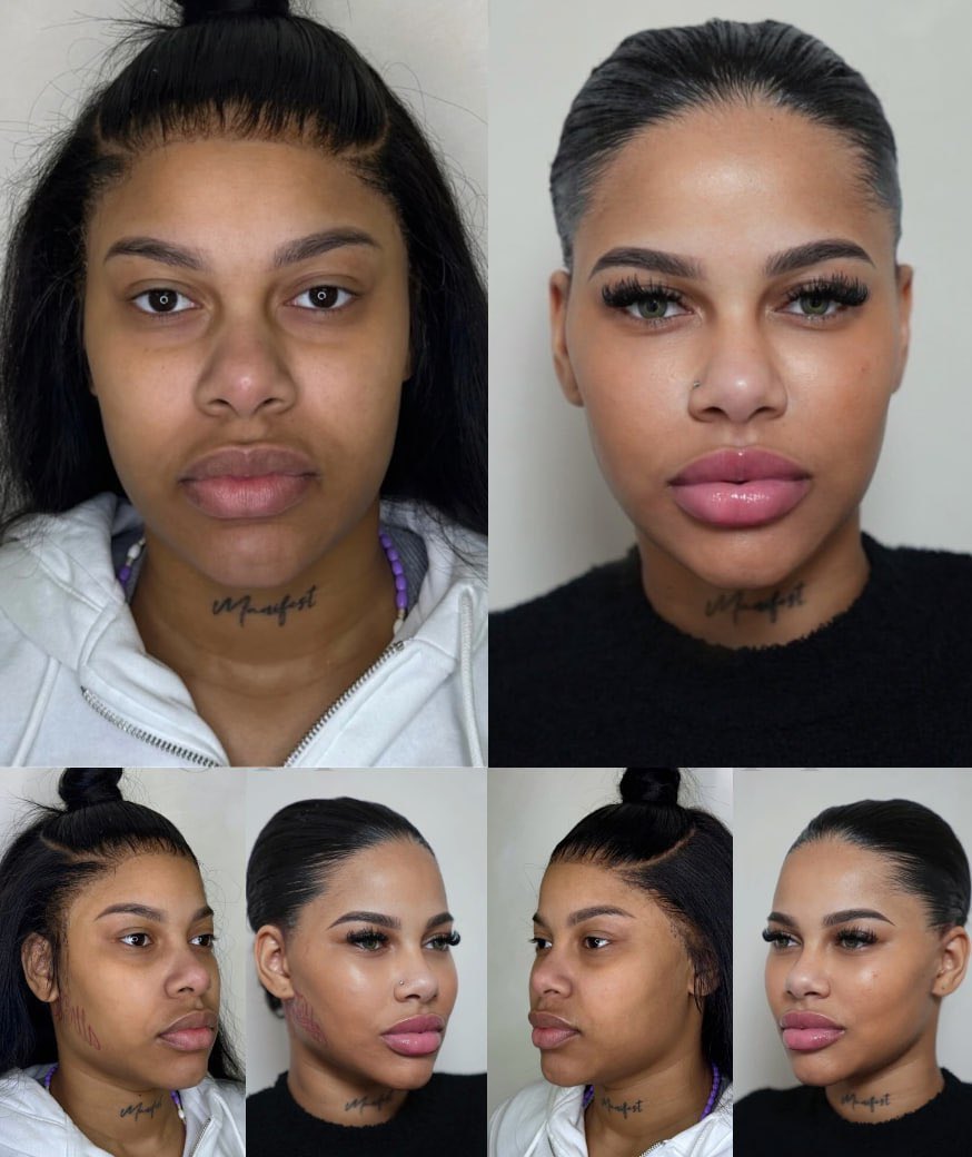 Mellow Rackz Child Rapper Mellow Rackz shows her before & after facial balancing glow-up 👀
