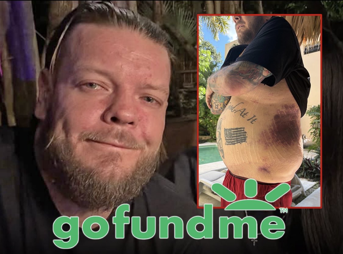 klyrova's tweet photo. "Pawn Stars" star Corey Harrison is turning to fans for help after spending nearly all his money on medical bills following a scary motorcycle crash in Mexico ... and the life-threatening complications that followed. https://t.co/ePMMrJZbgT
