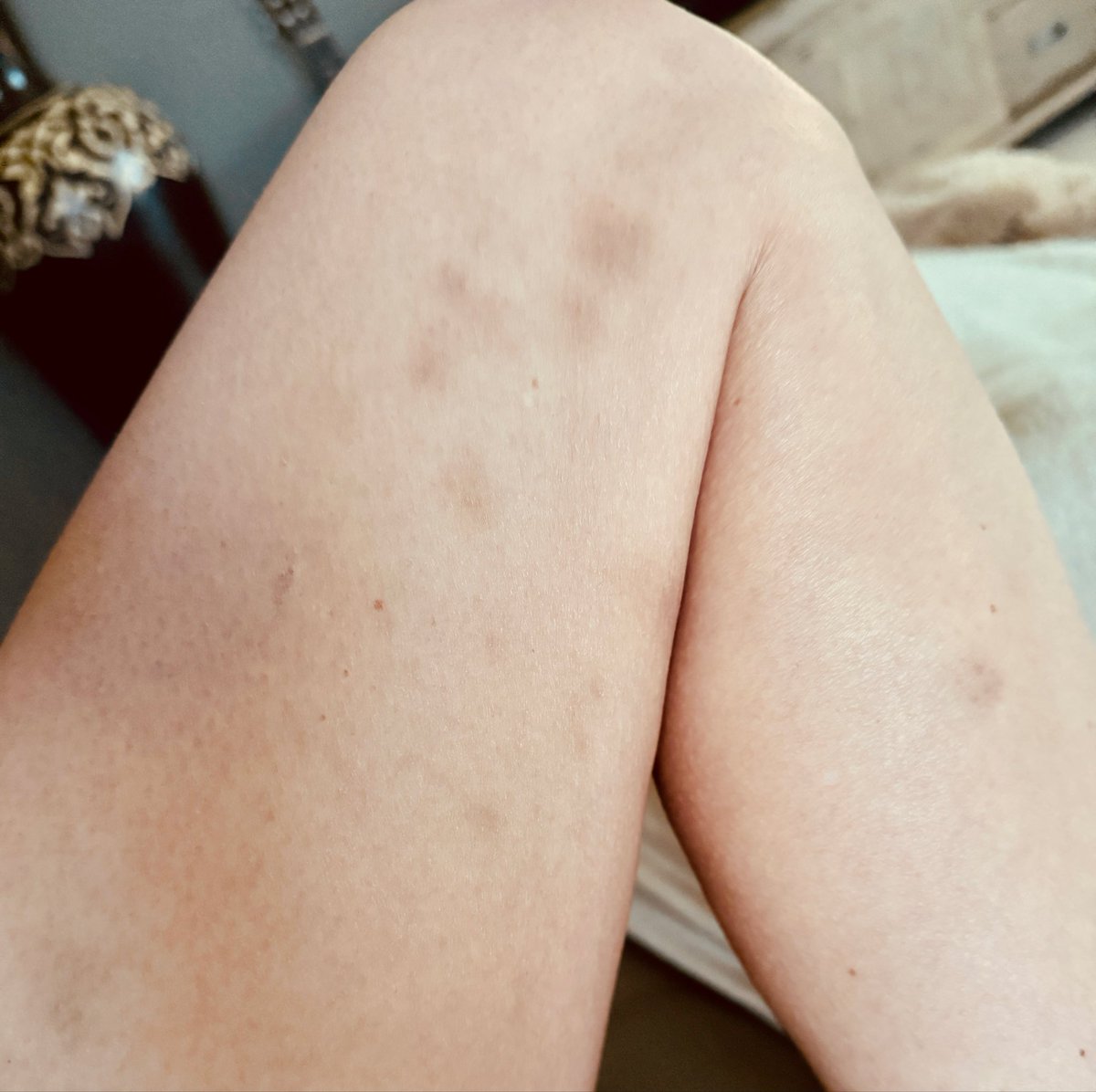 Reprise du cirque aérien.
La discipline où tu passes 90 % du temps à expliquer que non, personne ne te bat à la maison. 🎪