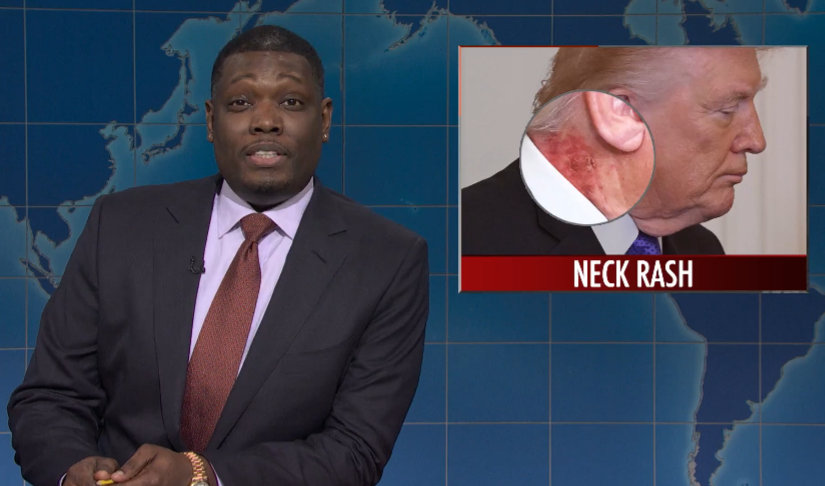 Fam4Fun's tweet photo. @nbcsnl #SNL WeekendUpdate
A rash has appeared on Pedophile Trump's
neck just above his collar.

Apparently, someone accidentally washed
his shirt in Holy Water!
#TrumpEpsteinFiles https://t.co/VPdwCcFafQ