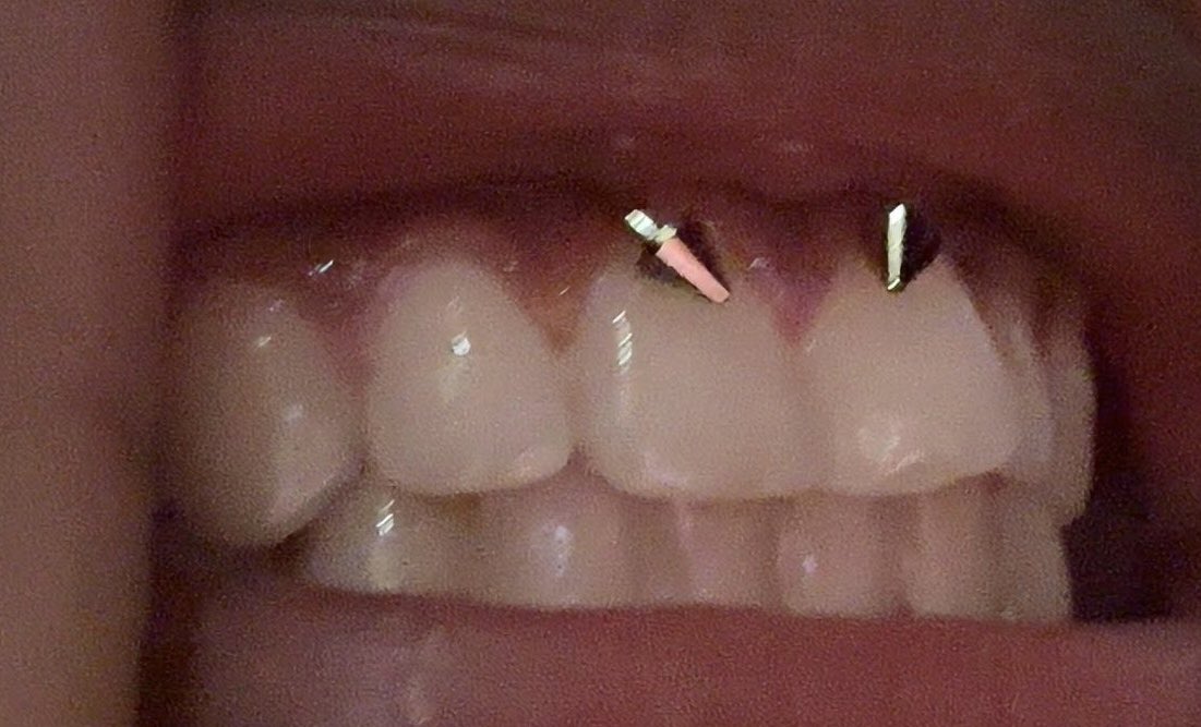 allmyyybones's tweet image. #Done