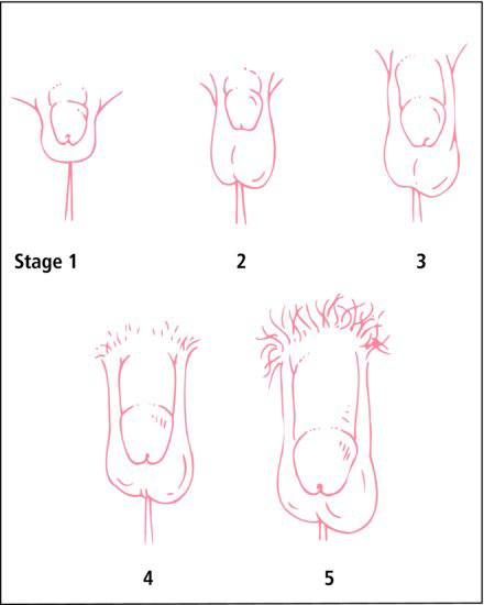 Most men think puberty is the only change. 

In reality, it's just stage 1

Here are 5 stages of P*nis:

//CHECK THREAD//👇