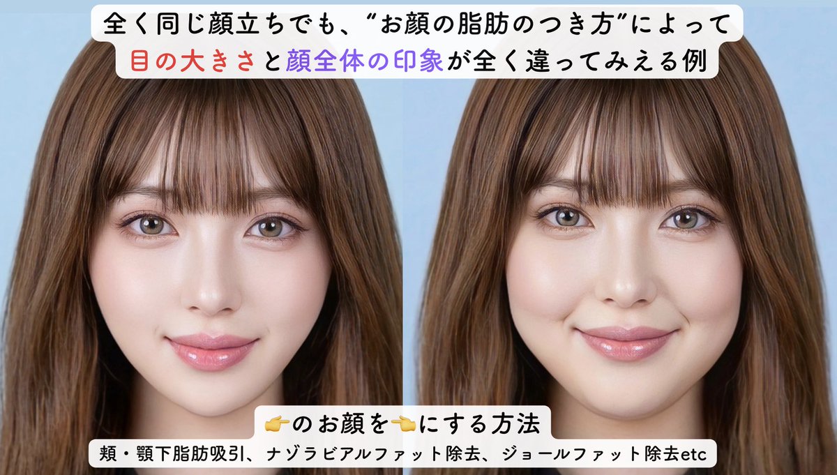 dr_hayami_'s tweet photo. 【”顔の脂肪"が多いと目の立体感がなくなります】

①脂肪の厚み
②お顔全体のメリハリ欠如
③輪郭が「丸・四角」型だと視線が外に分散される

👆の結果、相対的に“目が奥にあるように”見えてしまいます。

顔の印象は、パーツより“脂肪バランス” https://t.co/IBPN24yGo4