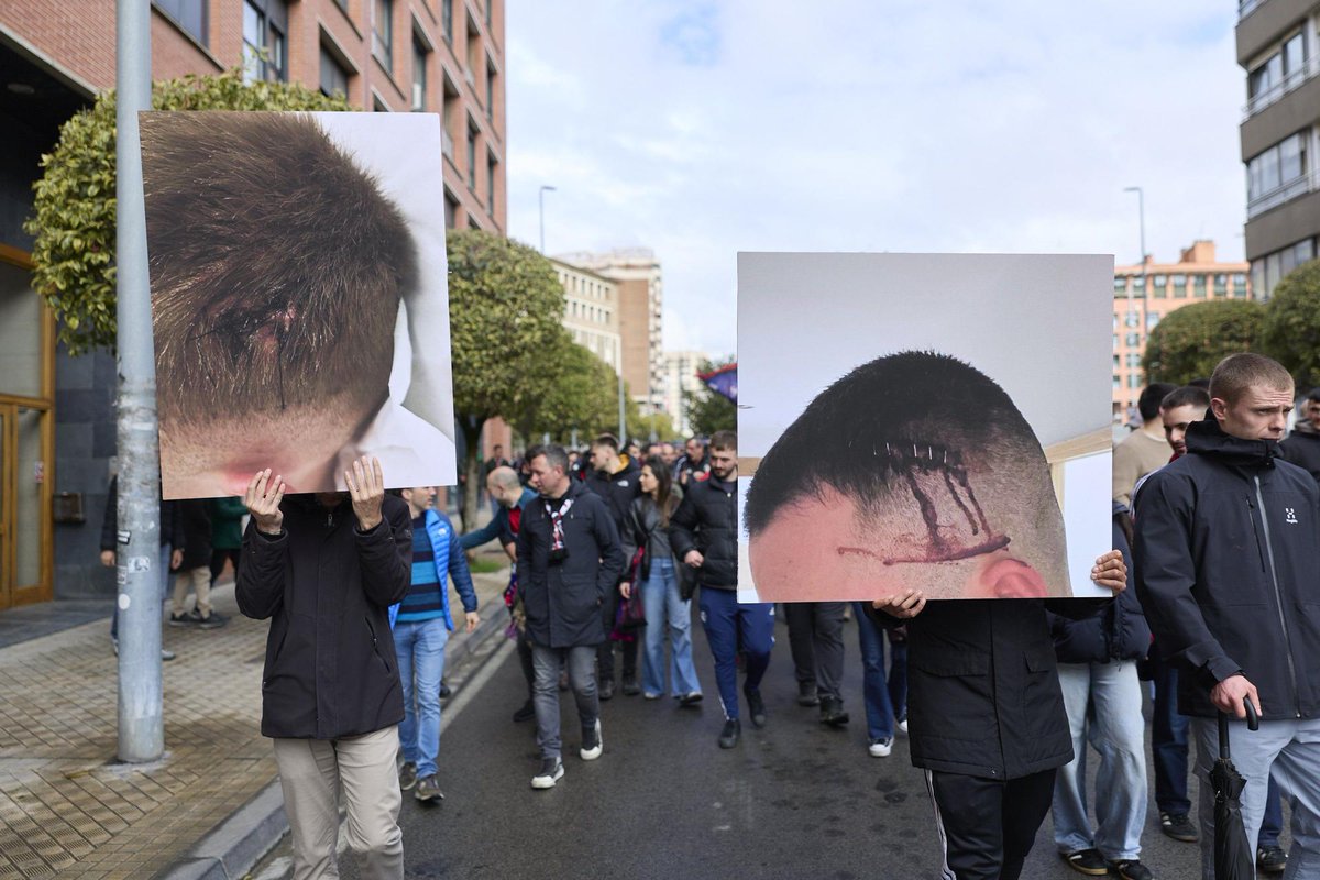 sadarbizirik's tweet photo. El osasunismo popular, sigue unido ante unas agresiones policiales que continúan sin autocrítica ni asunción de responsabilidades.
Por el contrario, el ensañamiento en forma de decenas de multas de miles de euros es una constante contra la afición.
📸Unai Beroiz, Iñigo Uriz. https://t.co/QV6InbSRuT