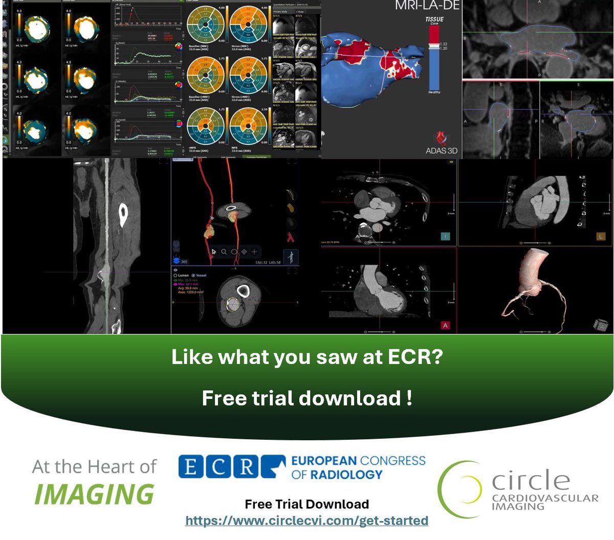 Circle Cardiovascular Imaging tweet media