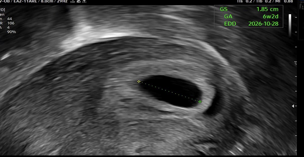 이불 _ bjd face up tweet media