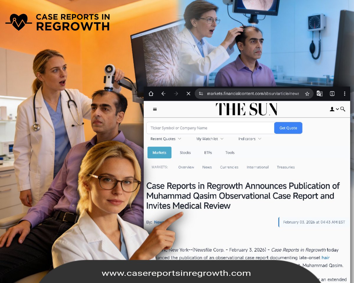 Have you seen Muhammad Qasim’s latest News of Regrowth Case? This changes everything in hair science.