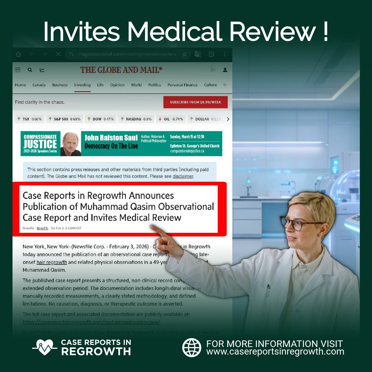 From sparse strands to dense growth, Muhammad Qasim’s hair is now clearly visible to the naked eye. Bald patches have disappeared. Press release included.