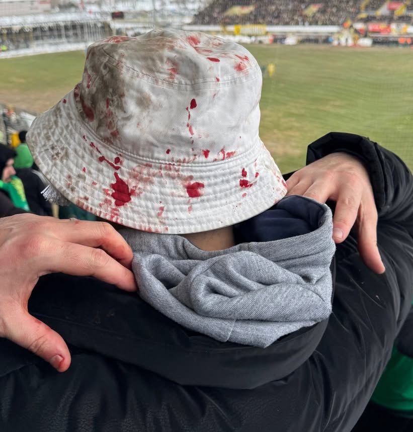 Muşta tribünlerimize çirkin saldırı!

Muş taraftarları tribünlerimize taş yağdırıyor.  TFF gör bunları! Paylaş, paylaştır!