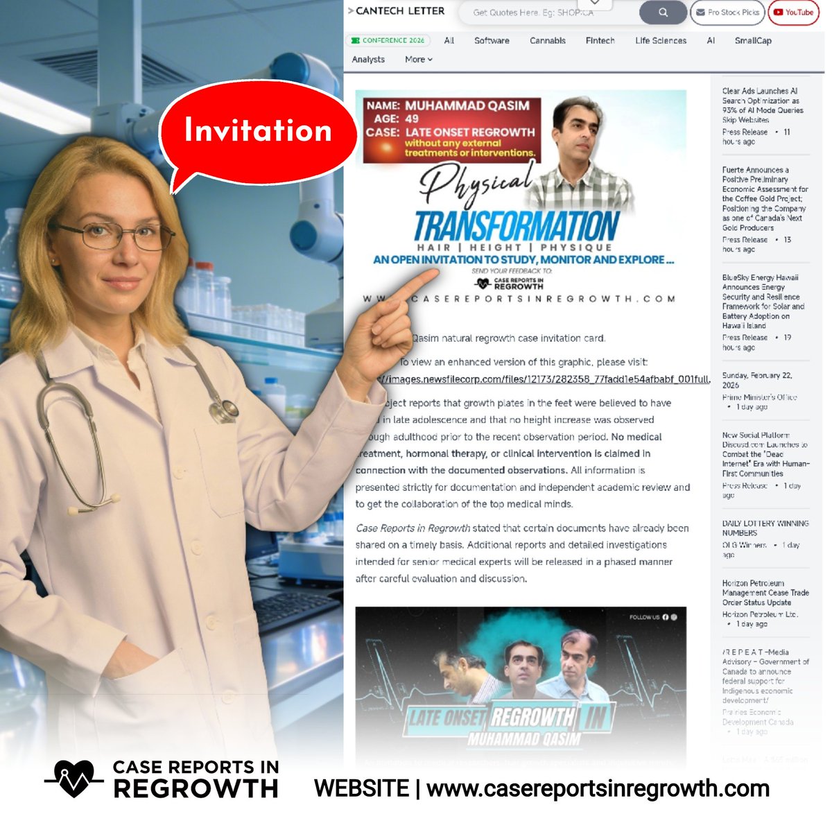 Measurable progress: Muhammad Qasim grows taller and regrows hair — bald patches now completely covered. Press release included.