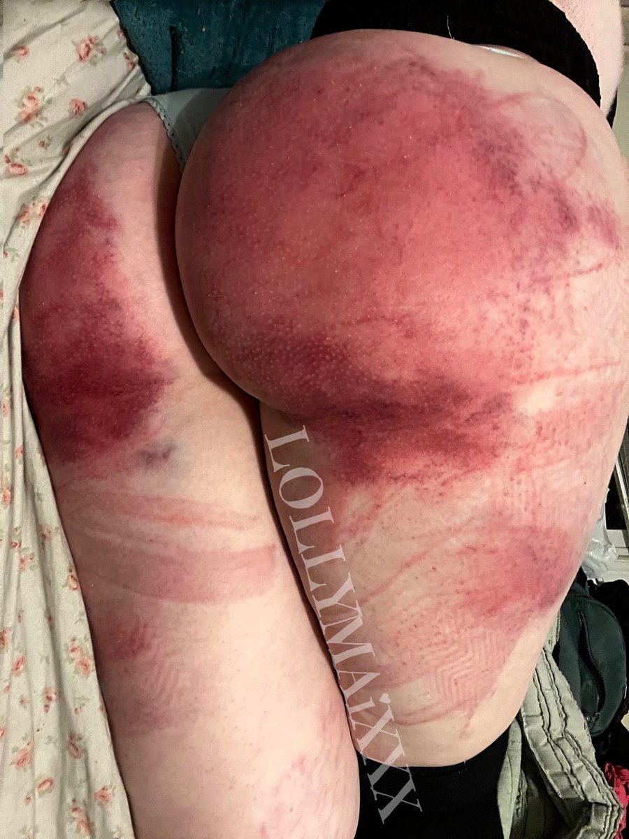 ؀⃟🐻‍❄️ ━ 𝑼𝑳𝑻𝑰𝑴𝑨𝑻𝑬 𝑫𝑬𝑺𝑷𝑨𝑰𝑹 tweet media