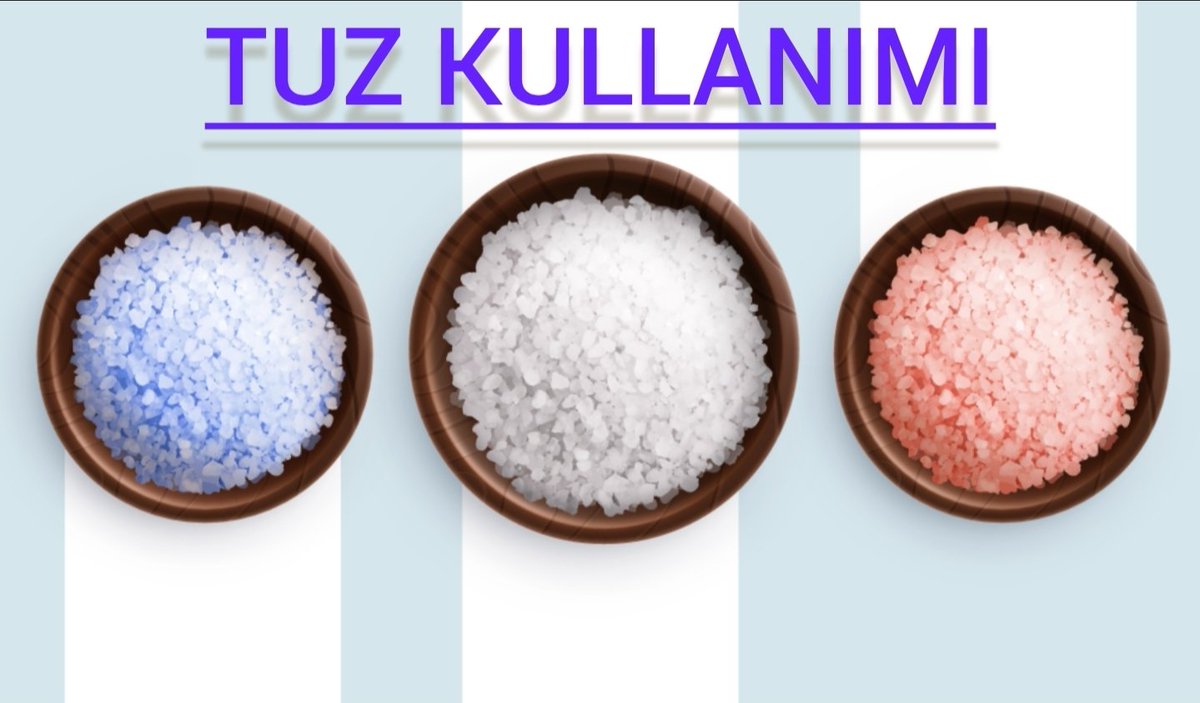 TraderAT12's tweet photo. 🔴AZ TUZ TÜKETMEK HER ZAMAN "İYİ DEGİLDİR"...!

▶️SORU: Karbonhidrat az, tuzu neredeyse hiç kullanmam...Ama buna ragmen sürekli KALP ÇARPINTISI, TAŞİKARDİ oluyor...Tetkiklerde bir şey çıkmıyor, NEDEN?

➖️CEVAP: Sorunun içinde...Öyle tuzu sifirlayamazsin...Kalp çarpıntısı oluşur...

💧Klasik ezber şu:
"Az tuz = her zaman iyi".....

👆 FİZYOLOJİ BÖYLE ÇALIŞMAZ.. 

🟥MEKANİZMA....
(Önce Temel Fizyoloji)
🔹️Sodyum (TUZ).

➖️Diyelim ki damarlarda basınç düştü, kan hacmi düştü, her yere istenildiği ladar gidemiyor, beyine bile oksijen akışı azaldi....

➖️Kalp kanı her yere ulastirmak için hızlı hızlı atmaya, kan pompalamaya çalışır, çarpıntı olur...
➖️Damarlarda hacmi artirmak için SODYUM ve SU lazim....

➖️Bu durumda Normalde olan; 
📍 Böbrekte... (Jukstaglomerüler Hücreler)

1️⃣ Sodyum düşerse (macula densa algılar)
2️⃣ Böbreğe gelen basınç düşerse
3️⃣ Sempatik aktivite artarsa... (B1 reseptör)
👆Bu üçünden biri olursa BÖBREKTEN RENİN salgilanir..

▶️ RENİN NE YAPAR?

💧Bobrekten salınan bu RENİN bir enzim...Gider Karaciğerin ürettiği ANJİYOTENSİNOJENİ keser....

💧Kesilen Anjiyotensinojen ,  ANJİYOTENSİN-1 ' e dönüşür...

⭐️ANJİYOTENSİN-1 hiç bir işe yaramaz...Bu sebeple ACE devreye girer...

🩸ACE = Angiotensin Converting Enzyme
En yoğun akciğer endotelinde bulunur....Covid zamaninda Coronavirusun skcigerde tutundugu molekül..

🩸ACE ne yapar?
Anjiyotensin 1'i alıp Anjiyotensin-2 'ye dönüştürur...
⭐️Asıl güçlü,iş yaoan molekül bu...

🩸Anjiyotensin-2 gide  "AT1" reseptörüne bağlanır...Bu baglanma sonrasi

🔹️Arteriyollerde vazokonstriksiyon (damarda daralma)
🔹️Efferent arteriyol daralması (GFR’yi korumak için bovrekte olan bir olay)
🔹️Aldosteron salınımı (adrenal korteks)
🔹️ADH salınımı (hipofiz)
🔹️Sempatik sistemi artırir
🔹️Susama merkezini uyarir
⭐️Yani tam bir "acil durum hormonu."

👆Bunlar ne yapar bakalim....

🔶️ALDOSTERON 
🔹️Aldosteron distal tübül ve toplayıcı kanalda ENaC kanallarını artırır...
🔹️Sodyum geri emilimini artırır( ahada bize bu lazim),
🔹️Potasyum atılımını artırır...
➖️Sonuç:
Sodyum artti
Sodyum su ceker,su da tutuldu
Kan hacmi ARTTI...
Basınç ARTTI.....
⭐️Kalp saçma sapan bir hizlanip bir yavas atmayi birakti....Artik normal ,guzel bir hızda atsada beyine kan gidecek, damarkarin içi dolacak..

🔶️ADH ne yapar?
🔹️Böbrektw yoplayıcı kanalda aquaporin kanallarını artırır.
🔹️Su geri emilir.
🔹️Kan hacmi ARTAR....(yine damarı doldurduk)

⏺️ Biz akcigerde ACE ile bir aniyotensin-2 yapmistik....işte o Anjiyotensin-2 
🔹️Noradrenalin salınımını artırır
🔹️Presinaptik geri alımı azaltır filan ama kafa karismasin oralara girmeyeyim...

👆Şimdi bu kişide Tuz (sodyum) vardı ve butun islemler gayet sağlıklı oldu.....Damarda basınç  kan hacmi olusturduk..

 ➖️ Bu sebeple
🔹️Tuz duyarlı hipertansiyonda
🔹️İleri kalp yetmezliğinde
🔹️Sirozda asit varsa
🔹️Nefrotik sendromda (bobrekte hasar varsa) TUZ ALIMINI KISITLIYORUZ...

🟢Peki şahsı ln hiç bir sıkıntısı yok....Niye ne kadar az tuz alirsan o kadar sağlık diyoruz? 
➖️HİÇ....Böyle saçmalık olmaz..

💧Ortada hic bir sebep yokken sürekli tuzu kısar, ya da sıfır tuz diyeti iygulamaya başlarsan

8️⃣ RAAS neden sempatik sistemi artırıyor?
▶️ vücut şunu düşünüyor:
❗️Kan hacmi düşmüş...Hayati organları korumalıyım, oksijen gitmezse beyin hasar alır...."
➖️O yüzden: az önce anlattigim RAAS  distemi devreye girer...
🔹️Kalp hızlanır
🔹️Damarlar daralır
🔹️Böbrek perfüzyonu korunur

👆Ama bunlar tuz (sodyum) varsa olur ve biter. .Ya tuz-sodyum düşükse? 
❗️SISTEM SÜREKLİ ÇALIŞIR....

➖️RAAS bu sekilde kronik aktif kalırsa; 

🔹️Endotel disfonksiyonu
🔹️Oksidatif stres
🔹️Vasküler hipertrofi
🔹️Fibroz artışı OLUR...

⭐️Yani sistem akut (kisa sureli) koruyucu.... kronik (sürekli) ise ZARARLI.

🔴SONUÇ

💧Sürekli düşük sodyum;
 RAAS + sempatik artış zinciri kronik aktif.

Renin 
Ang II 
Aldosteron 
Noradrenalin 
Vazokonstriksiyon 
Kalp hızı...Hepsi surekli artmış halde...
👆Bunun sonucu
🔹️ÇARPINTI..

(👇DEVAMI ALT TWİTTE 👇)