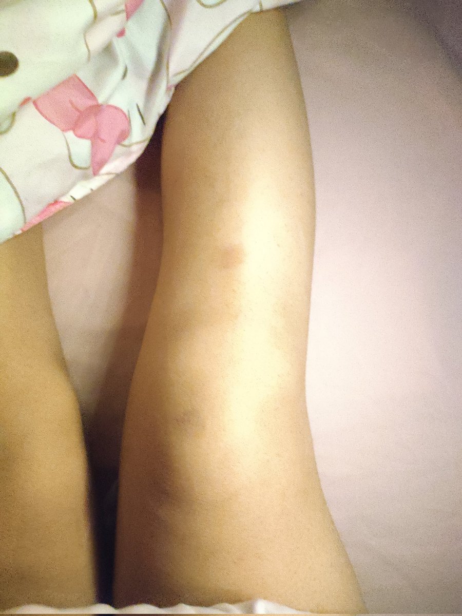 奶昔宝宝 tweet media