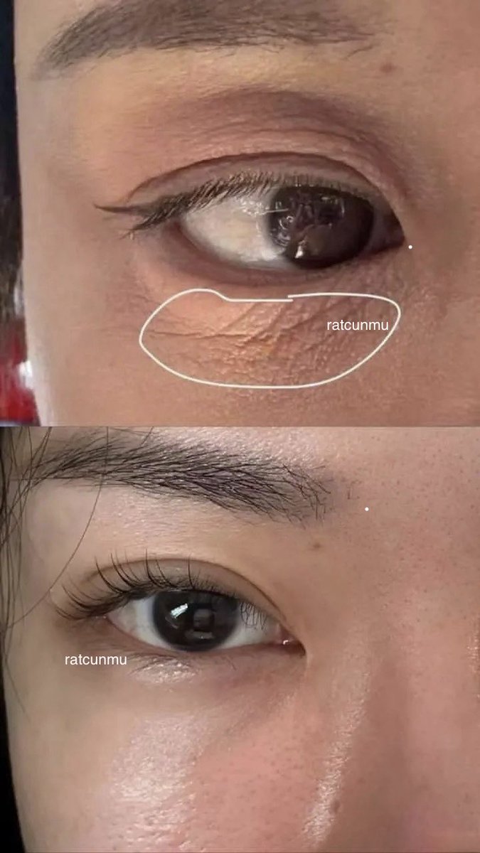 oopsinara's tweet photo. SUNGKEM🙏🏻 ini beneran works bawah mata yang tadinya keliatan kering &amp; banyak garis sekarang lebih smooth.￼ https://t.co/U4ecY7D5EG