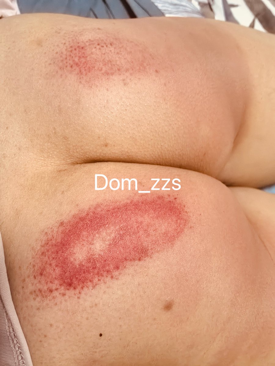 Dom_zzs's tweet photo. 好久没有更新了 #Spank #性虐 https://t.co/KrT2e5KkAp