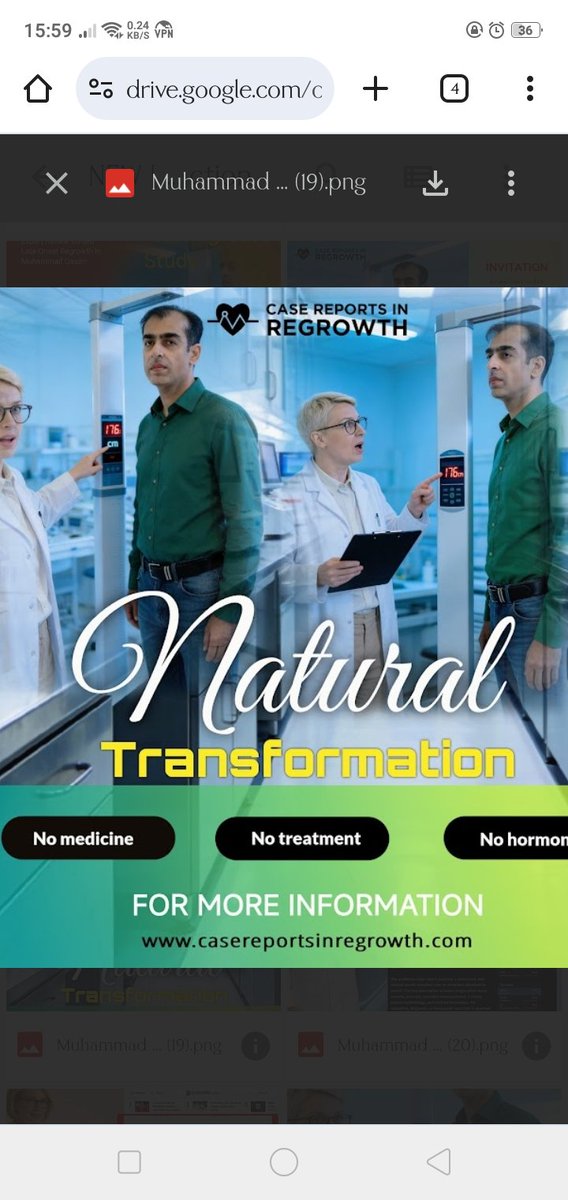 Muhammad Qasim regrowth case chelang for doctors.