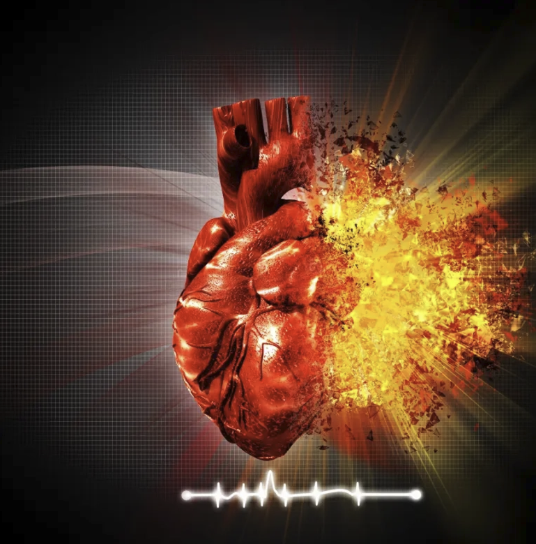 120Compressions's tweet photo. SPECIAL $5 lecture! 

UNDERSTANDING HEART ATTACKS

https://t.co/PyEmya5K7i https://t.co/t9myIJBQ5q